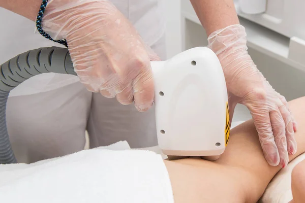 Laser epilation of armpits