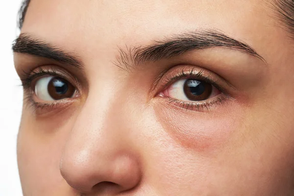 Kobieta z efektu czerwonych oczu — Zdjęcie stockowe