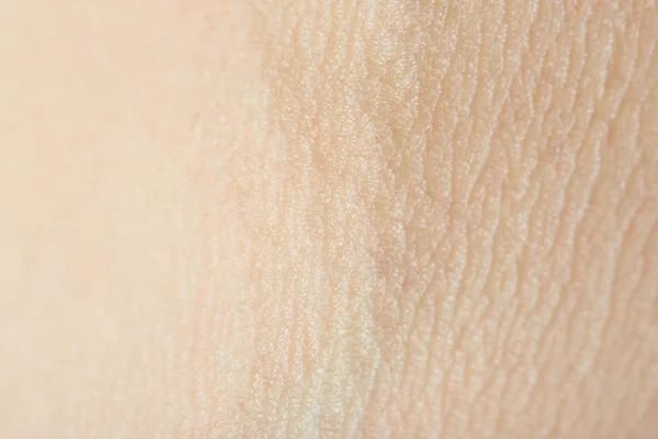 Linhas na pele humana — Fotografia de Stock