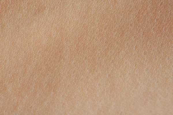 Cellen op de menselijke huid — Stockfoto