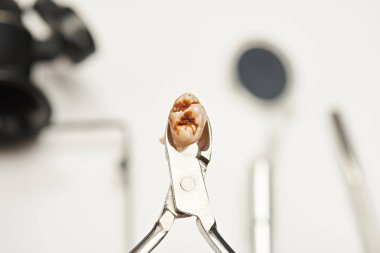 Sarı hasarlı çürük dişler