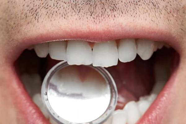 Controllo dei denti dentali — Foto Stock