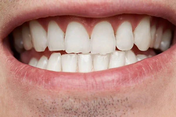 Macro de dents d'homme en bonne santé — Photo