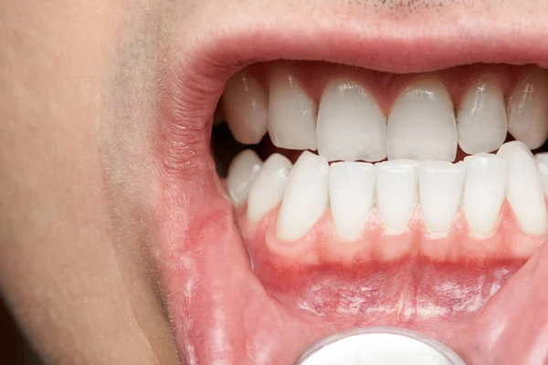Mannen mun med friska tänder — Stockfoto