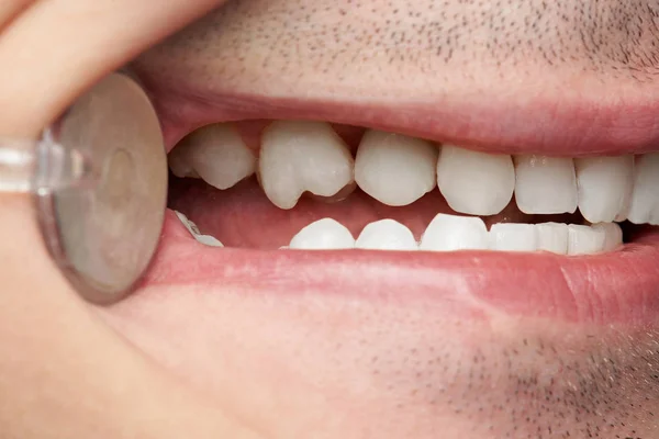 Closed mouth with clean white teeth — Stock Photo, Image