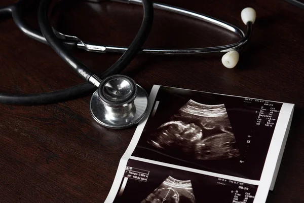 Yakın çekim stetoskop ve ultrason taraması