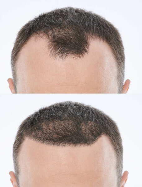 Смелые проблемы лечения
