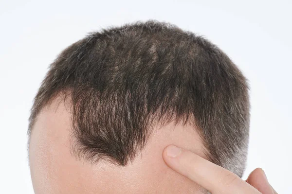 Homem a verificar o cabelo — Fotografia de Stock