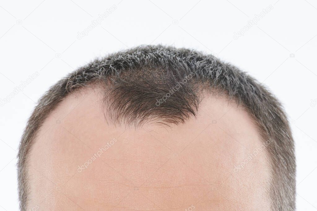 Close up of man bold head isolated on white background