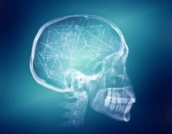 Obraz rentgenowski ludzkiej czaszki. Koncepcja sztucznej inteligencji — Zdjęcie stockowe