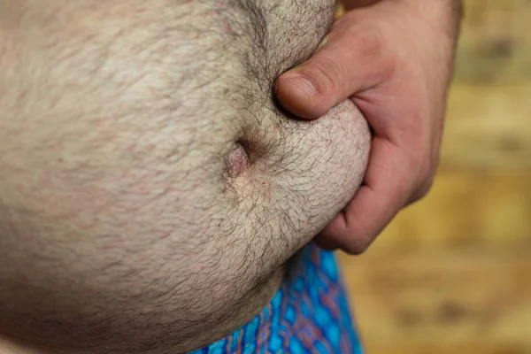 Vientre de hombre con sobrepeso. tiempo para una dieta —  Fotos de Stock