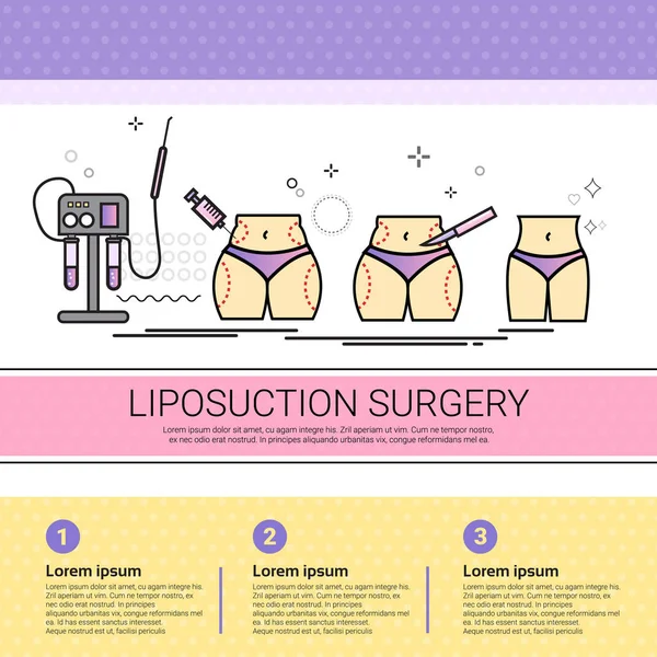 Liposucción Cirugía Cosmetología Infografías Salón Médico Cosméticos Procedimientos Set Banner con Copia Espacio — Archivo Imágenes Vectoriales