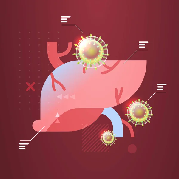 感染人类肝脏的Mers-Cov浮动流感病毒细胞Wuhan coronavirus 2019-ncov大流行病 — 图库矢量图片