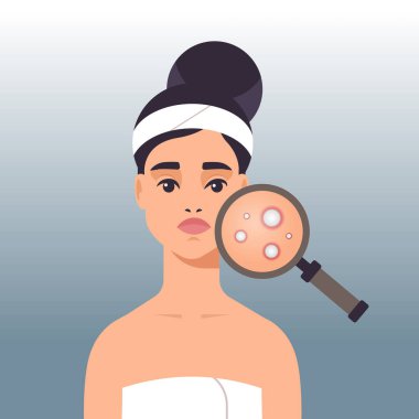 Yüzünde sivilce olan bir kadın. Cilt problemi olan bir kız. Yüzdeki sivilceleri bulmak için büyütücü kullanıyor.