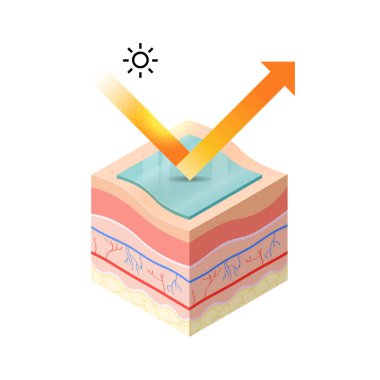 Güneş kremi ile korunan cilt vatozu, insan derisinin enine kesitinin üst derisine nüfuz eder.