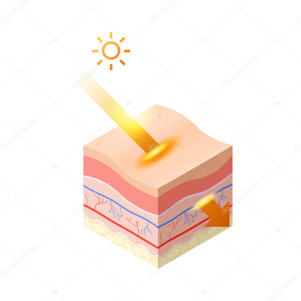 uv ray from sun penetrate into epidermis of skin cross-section of human skin layers structure skincare medical concept flat