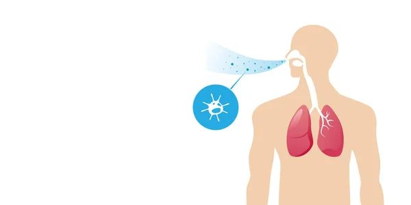 Cuerpo humano con pulmones afectados por bacterias y hongos de células virales en la respiración del ser humano de respirar retrato horizontal — Vector de stock