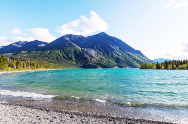 Kanada'da dağ gölü sakin sahne 