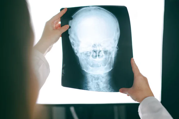 Médecin féminin regardant l'image radiographique de la tête humaine — Photo