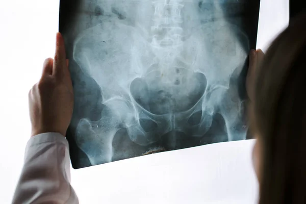 Female doctor examining pelvis x-ray in hospital office — Stock Photo, Image