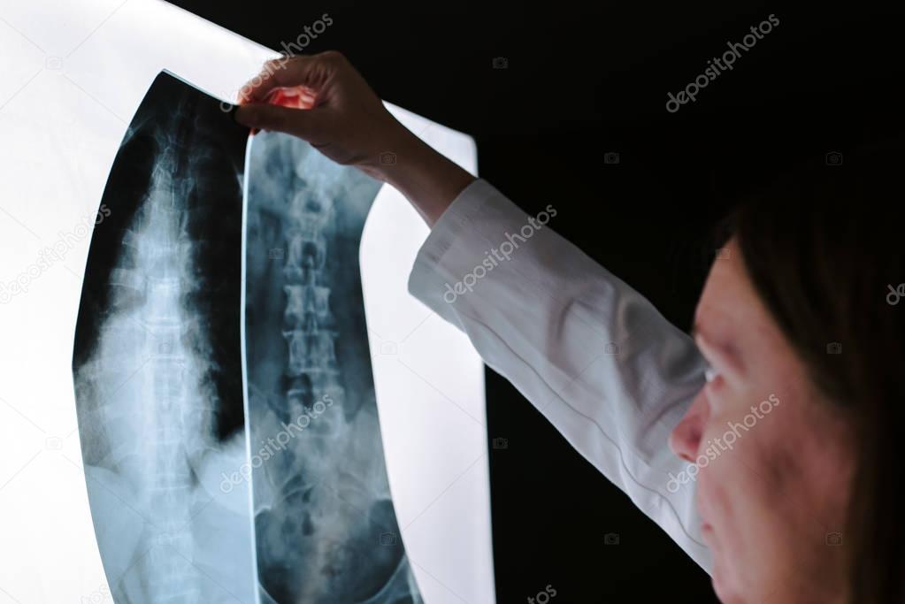 Female doctor examining spinr x-ray in hospital office