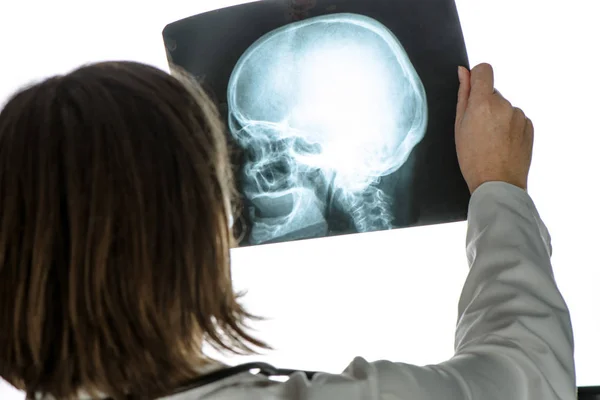 Médico analisando imagem de rastreamento de raio-x do crânio humano — Fotografia de Stock