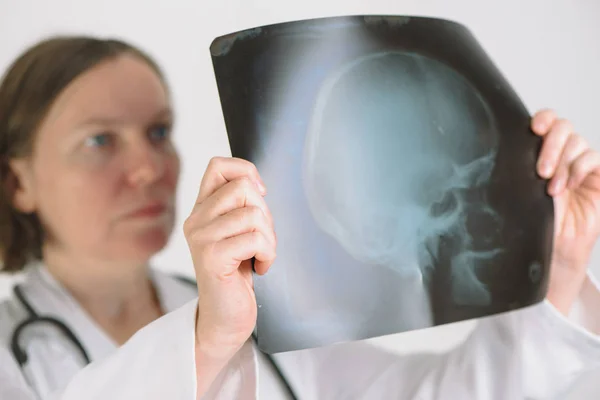 Médico analisando imagem de rastreamento de raio-x do crânio humano — Fotografia de Stock