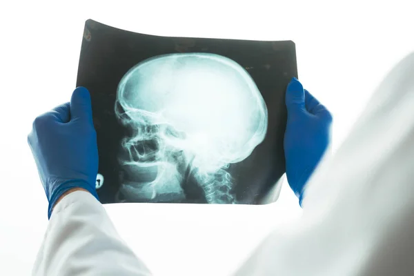 Doctor examining x-ray of the skull — Stock Photo, Image