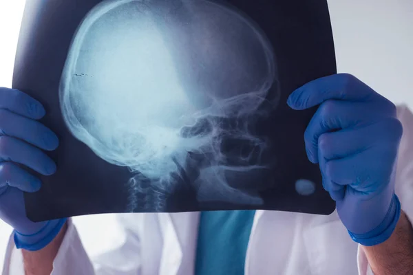 Médecin examinant la radiographie du crâne — Photo