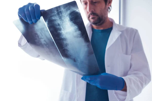 Médico examinando rayos X de la columna vertebral humana — Foto de Stock