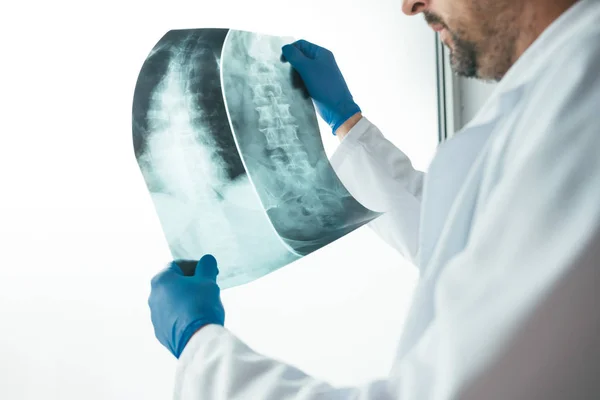 Médecin examinant la radiographie de la colonne vertébrale humaine — Photo