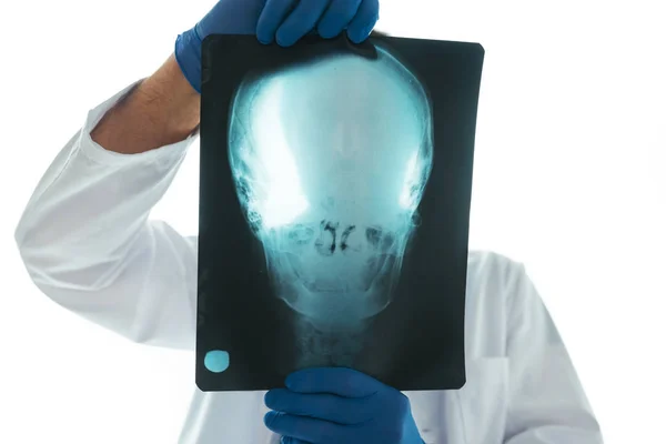 Médecin examinant la radiographie du crâne — Photo