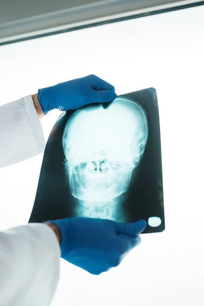 Läkaren undersöker röntgen av skallen — Stockfoto