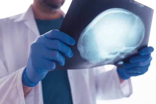 Médico examinando raio-X do crânio — Fotografia de Stock