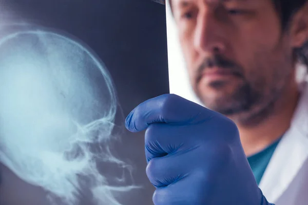 Доктор вивчає рентген черепа — стокове фото