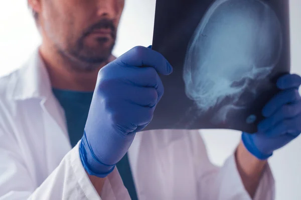 Doctor examining x-ray of the skull — Stock Photo, Image