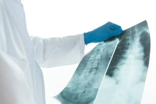 Doctor examining x-ray of the human spine — Stock Photo, Image