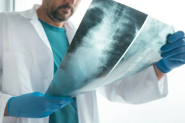 Arzt untersucht Röntgenbild der menschlichen Wirbelsäule — Stockfoto