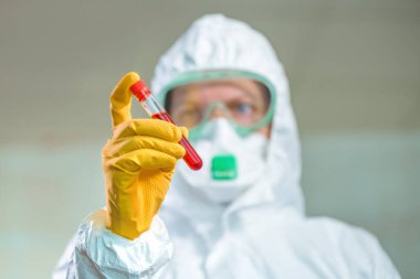 Epidemiyoloji uzmanı virüs karantinasında tıbbi örnek test tüpünü inceliyor, viral enfeksiyon salgını sırasında hastanın kanını test ediyor.
