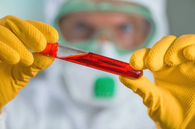 Epidemiyoloji uzmanı virüs karantinasında tıbbi örnek test tüpünü inceliyor, viral enfeksiyon salgını sırasında hastanın kanını test ediyor.