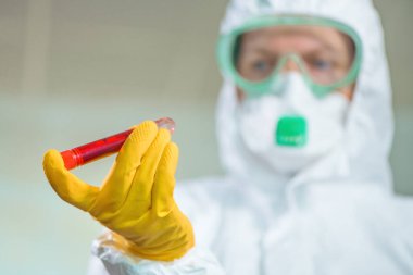Epidemiyoloji uzmanı virüs karantinasında tıbbi örnek test tüpünü inceliyor, viral enfeksiyon salgını sırasında hastanın kanını test ediyor.