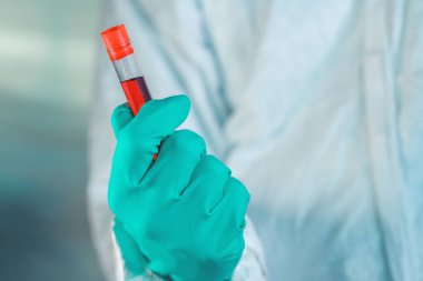 Test tüpünde kan örneği olan epidemiyoloji uzmanı, seçici odaklanma