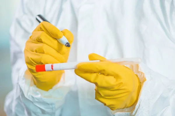 Epidemiologista Escrevendo Amostra Médica Tubo Teste Swab Seco Quarentena Vírus — Fotografia de Stock