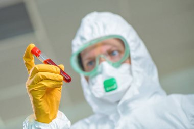 Epidemiyoloji uzmanı virüs karantinasında tıbbi örnek test tüpünü inceliyor, viral enfeksiyon salgını sırasında hastanın kanını test ediyor.