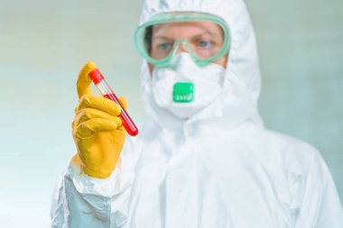 Epidemiyoloji uzmanı virüs karantinasında tıbbi örnek test tüpünü inceliyor, viral enfeksiyon salgını sırasında hastanın kanını test ediyor.