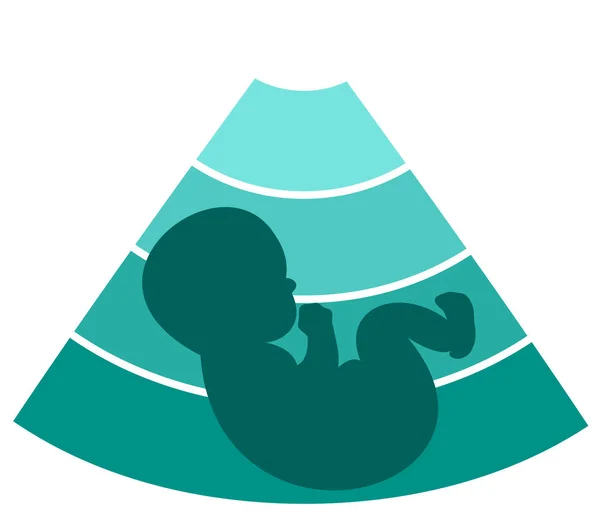 Conception de silhouette de foetus — Image vectorielle