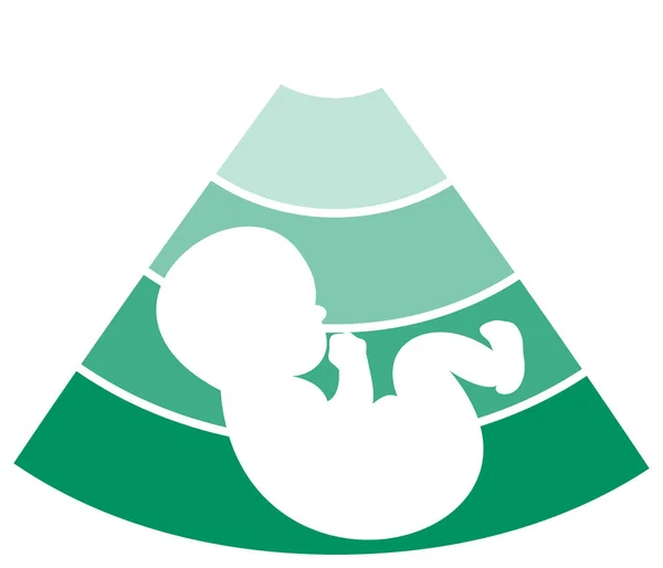 Έμβρυο σιλουέτα σχεδιασμού — Διανυσματικό Αρχείο