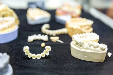 Diş implantları Kliniği