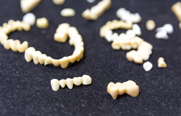 Зубні імплантати в клініці — стокове фото