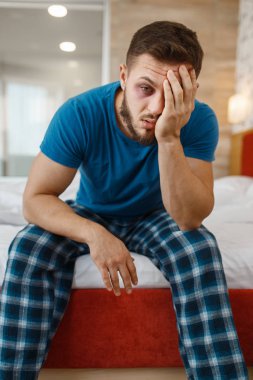 Yorgun adam yatakta uyandı. İçki sersemliği, baş ağrısı ve depresyon geçiren erkek, kötü bir sabah.